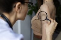 female-doctor-diagnosing-melanoma-body-female-patient